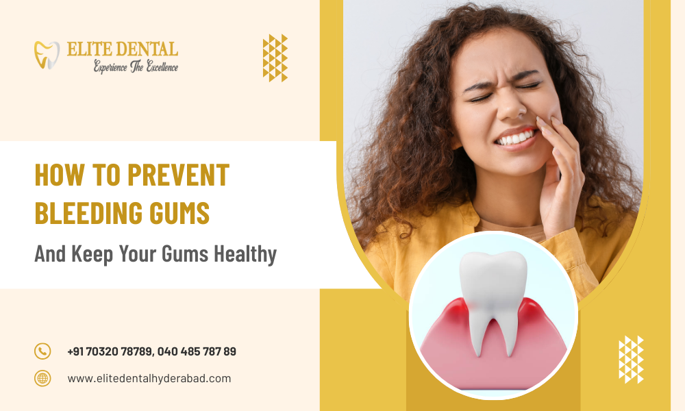 How to Prevent Bleeding Gums and Keep Your Gums Healthy