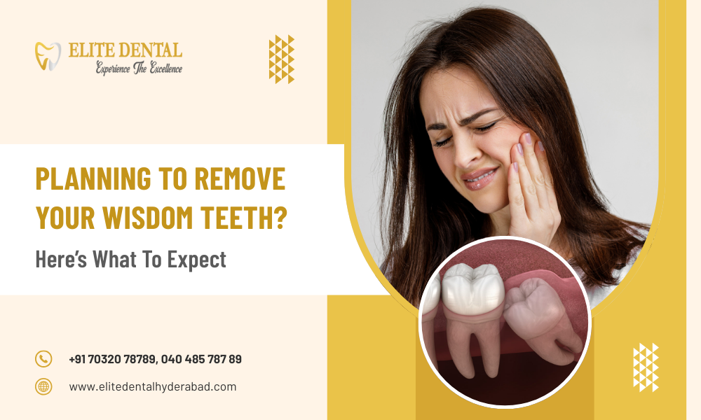 Planning To Remove Your Wisdom Teeth? Here’s What To Expect