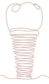 shape