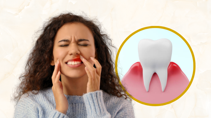 Bleeding Gum Treatment In Raghavendra Colony Kondapur
