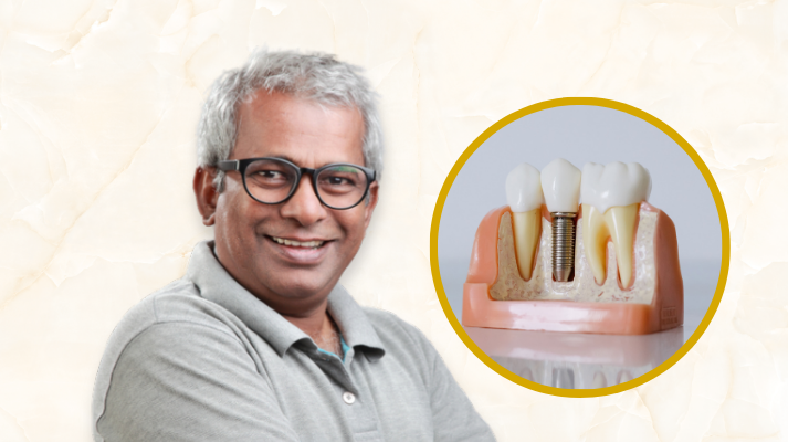 Dental Implant 