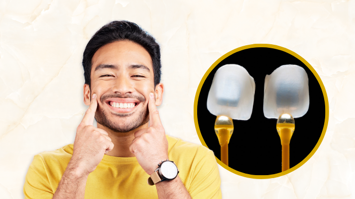 Dental Veneers And Laminates In Kondapur