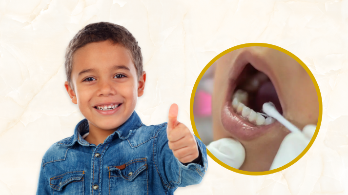Fluoride Application And Dental Sealant In Kondapur