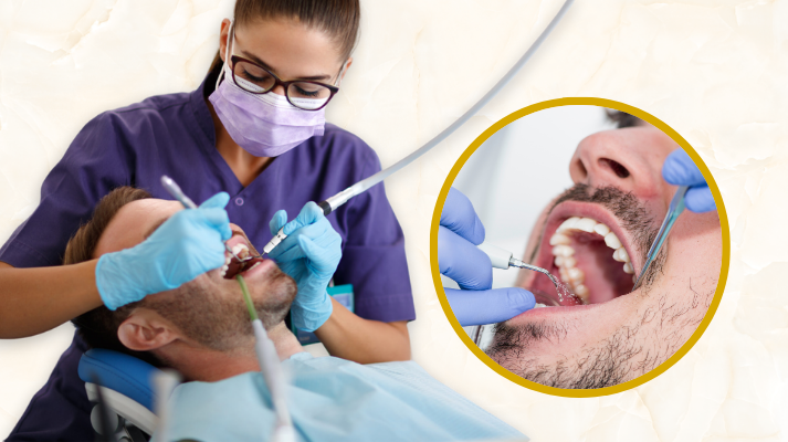 Teeth Cleaning