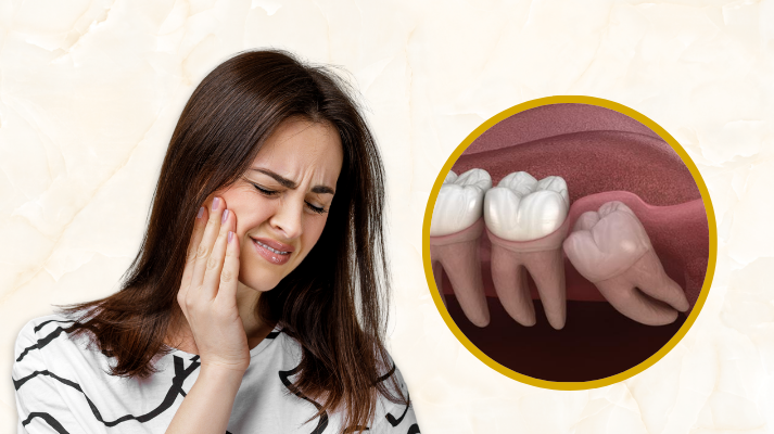 Wisdom Tooth Removal In Kondapur