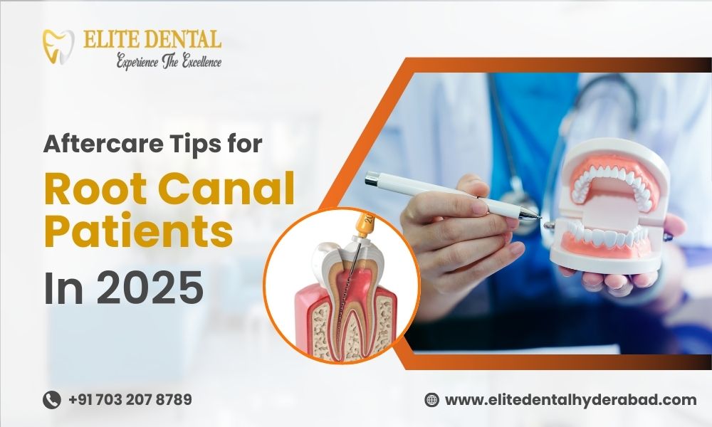 Aftercare Tips for Root Canal Patients in 2025