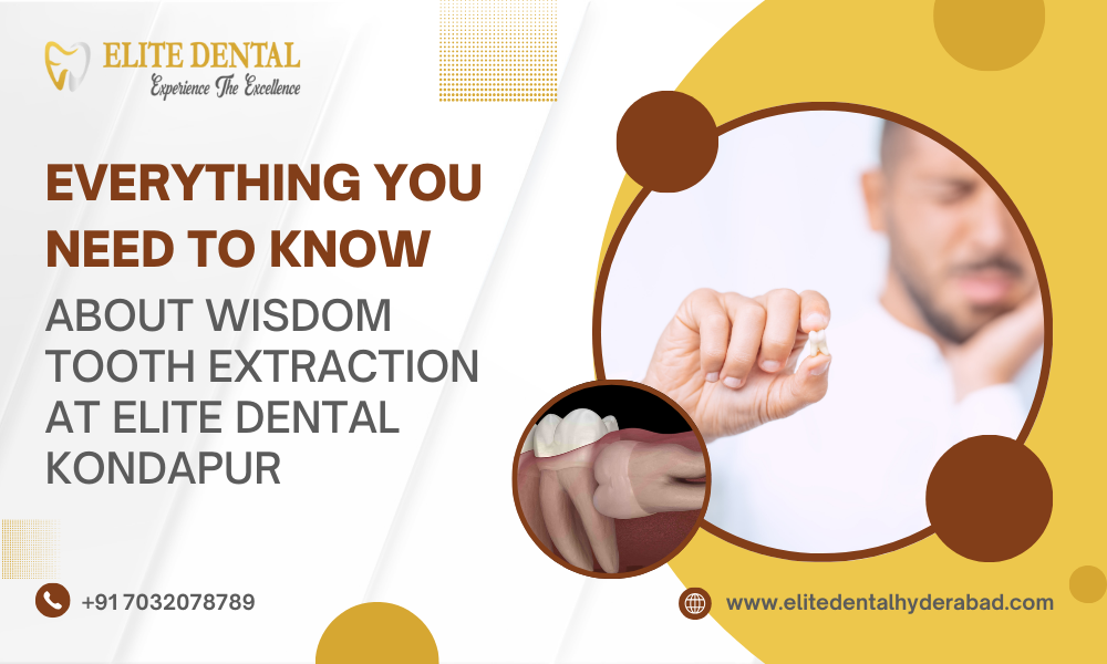 Everything You Need to Know About Wisdom Tooth Extraction