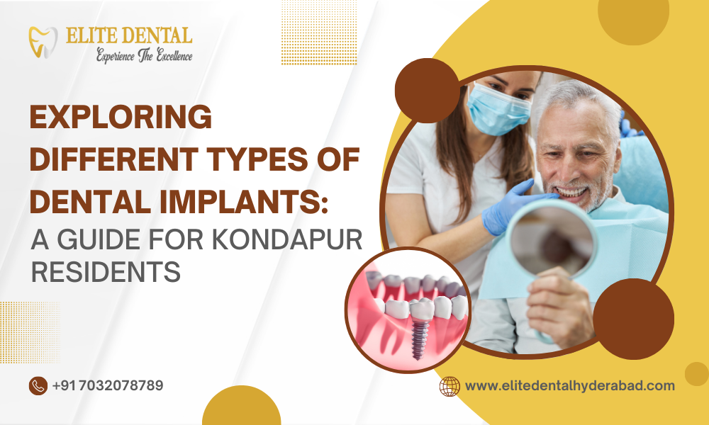 Exploring Different Types of Dental Implants: A Guide for Kondapur Residents