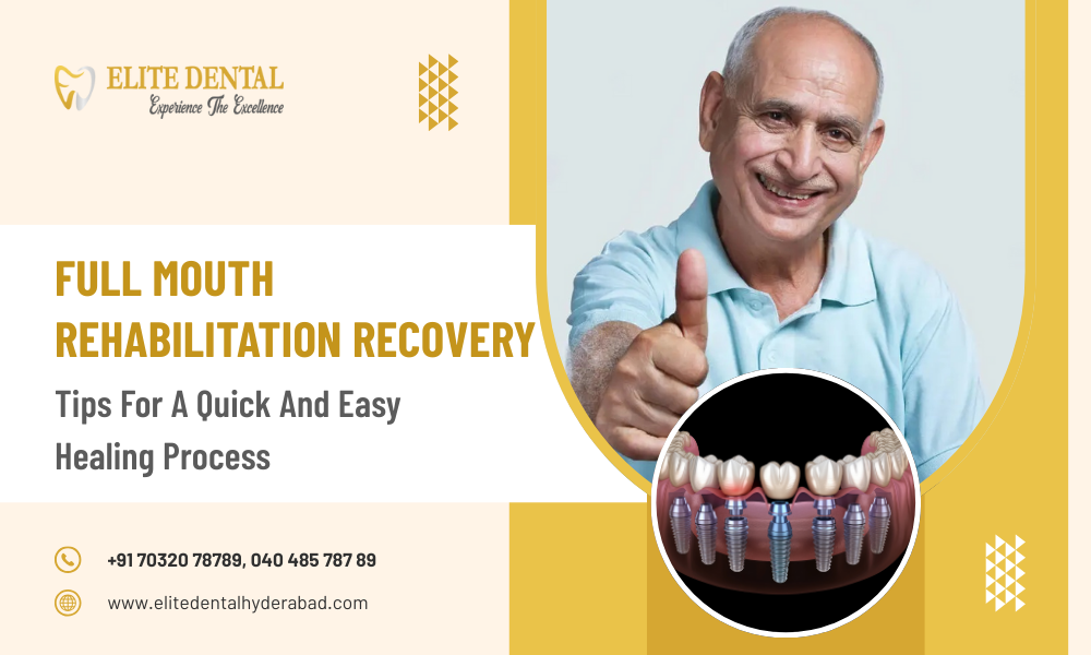 Full Mouth Rehabilitation Recovery: Tips for a Quick and Easy Healing Process