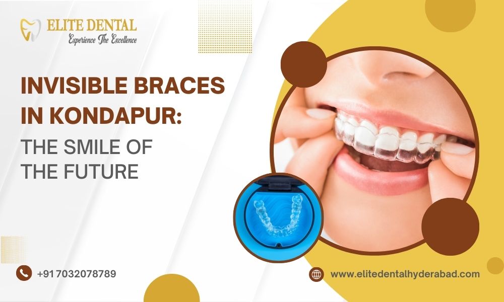Invisible Braces in Kondapur: The Smile of the Future