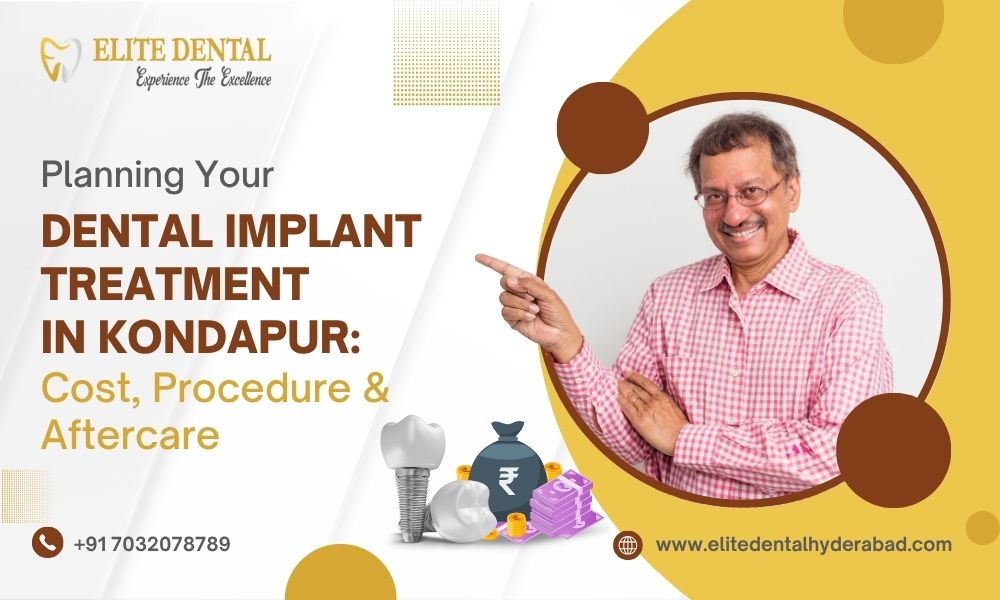 Planning Your Dental Implant Treatment in Kondapur: Cost, Procedure & Aftercare