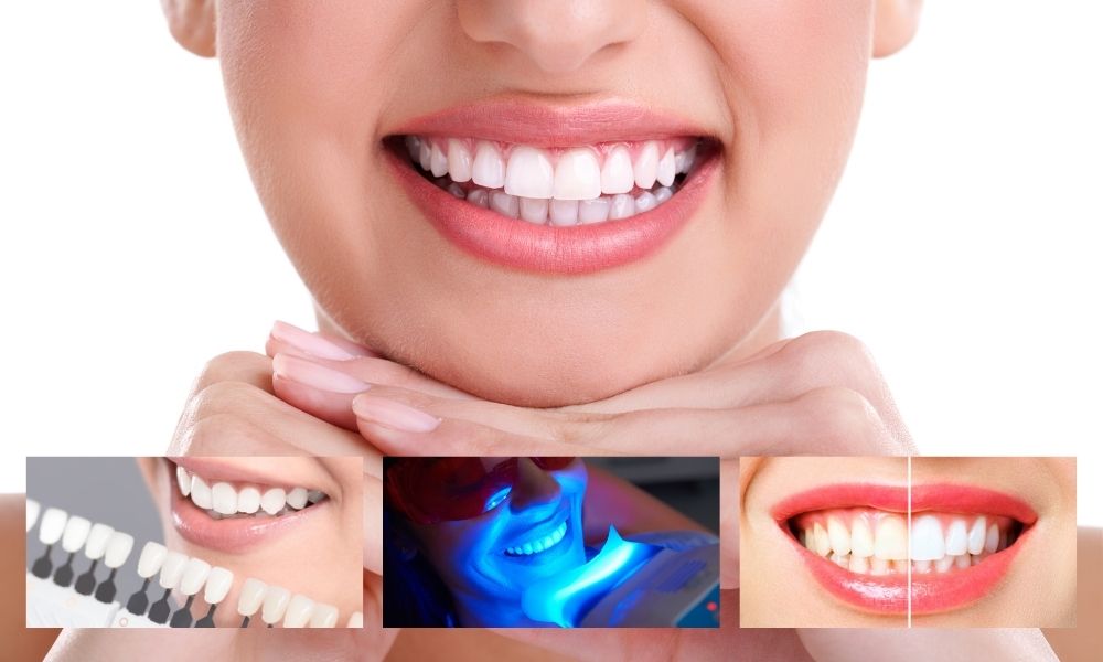 The Benefits of Investing in Cosmetic Dental Treatments