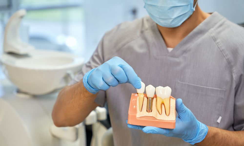 The Cost of Dental Implants in 2025: Are They Worth It?