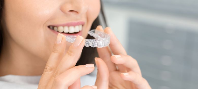 Top Benefits of Choosing Invisible Braces for Orthodontic Treatment