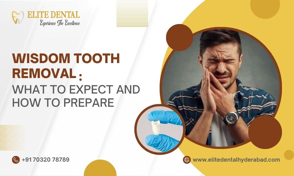 Wisdom Tooth Removal: What to Expect and How to Prepare