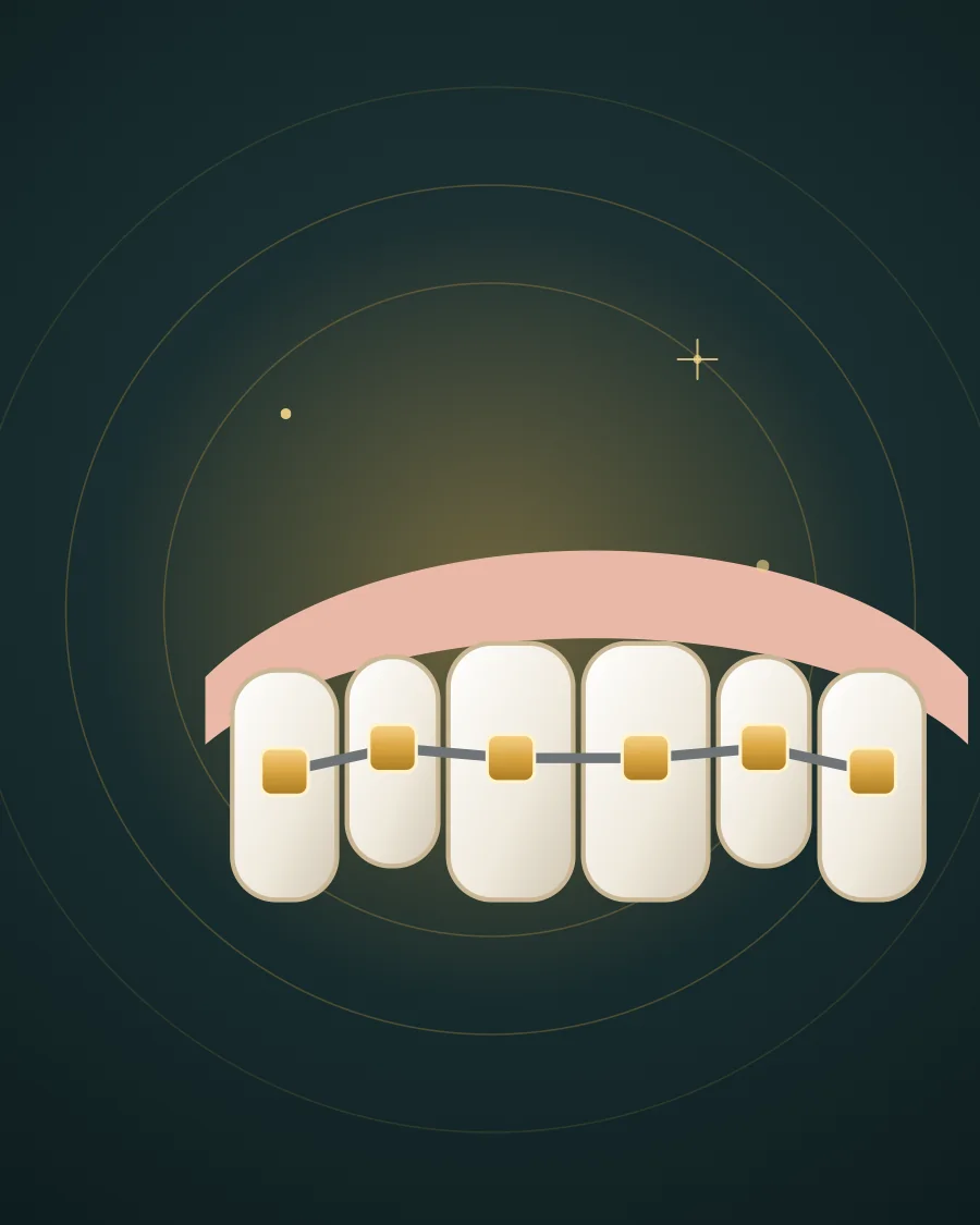 Illustration of a child's jaw with one bracket and an arch wire and arrows showing jaw growth, drawn in Elite Dental gold and charcoal