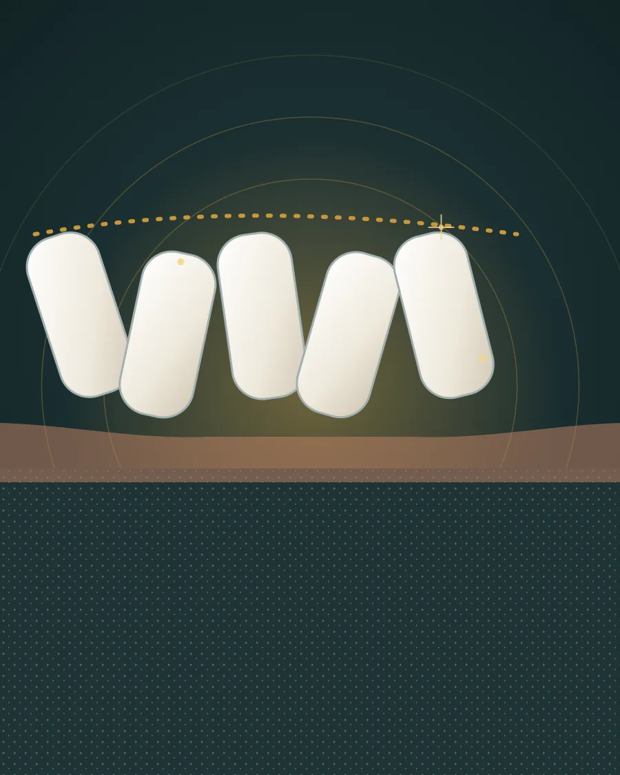 Illustration of five crowded, overlapping and twisted teeth with a dotted gold line showing where a straight row would sit, drawn in Elite Dental gold and charcoal