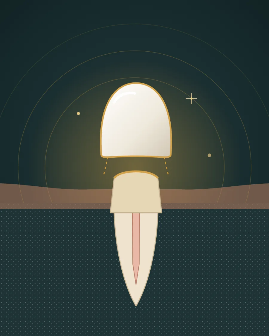 Illustration of a dental crown lifted above a shaped tooth, drawn in Elite Dental gold and charcoal