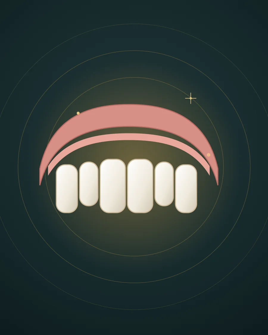 Illustration of an upper denture with a row of replacement teeth in a pink base, drawn in Elite Dental gold and charcoal