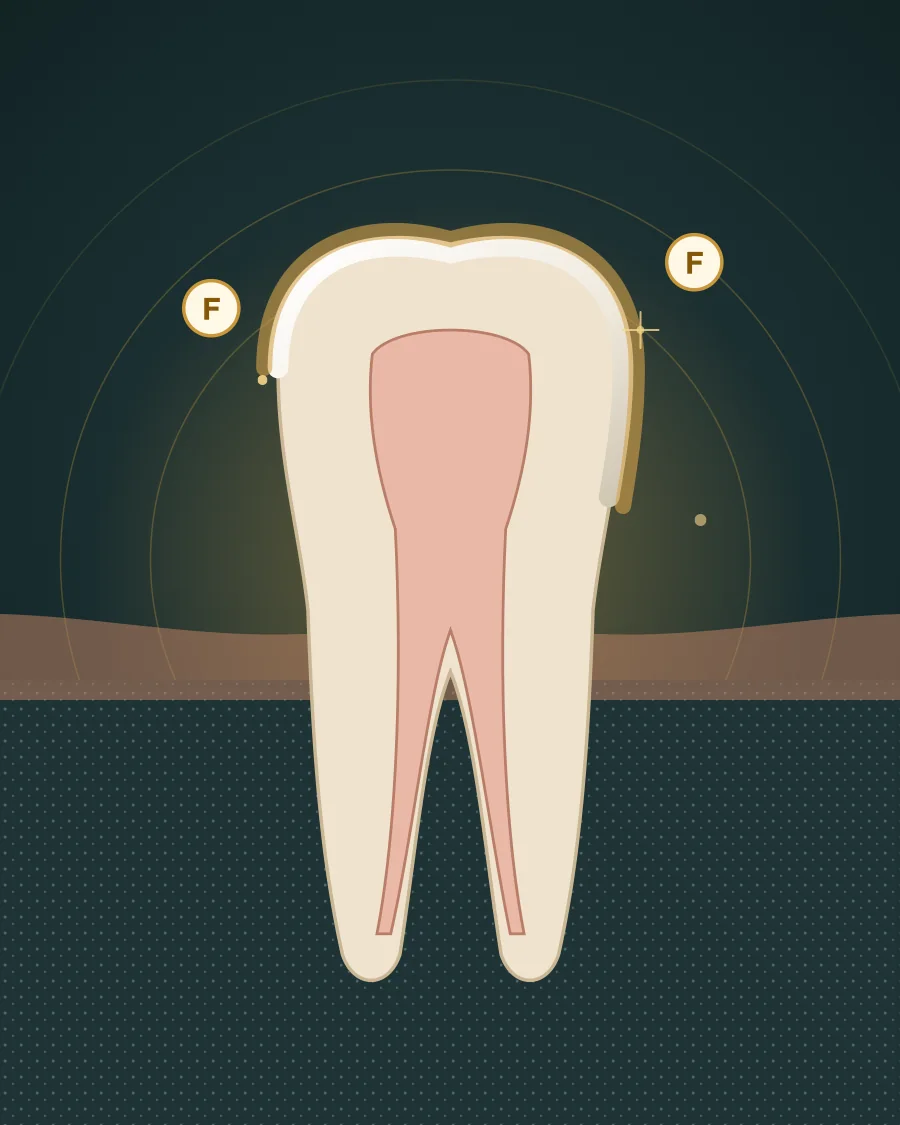 Illustration of a tooth with a protective fluoride layer on its surface and a small brush applying varnish, drawn in Elite Dental gold and charcoal