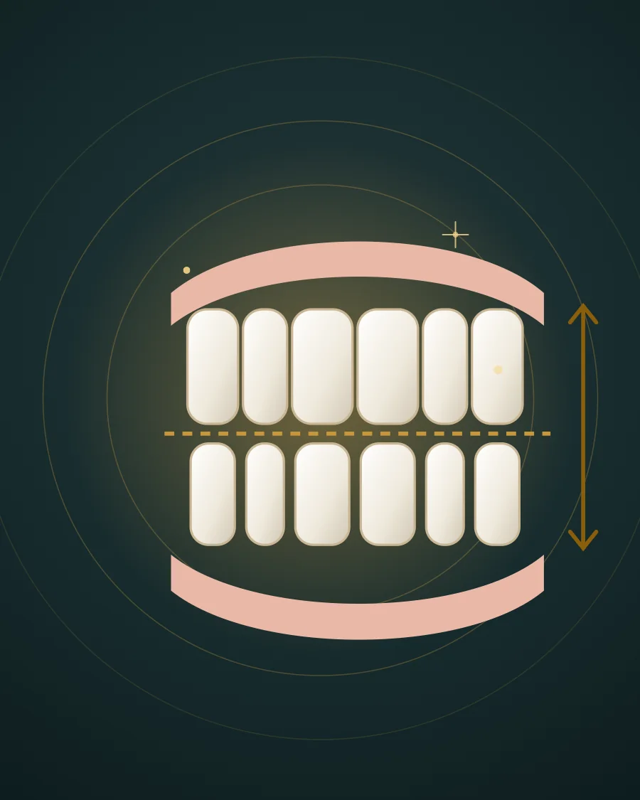 Illustration of upper and lower teeth with the bite line between them and an arrow showing the height of the bite, drawn in Elite Dental gold and charcoal
