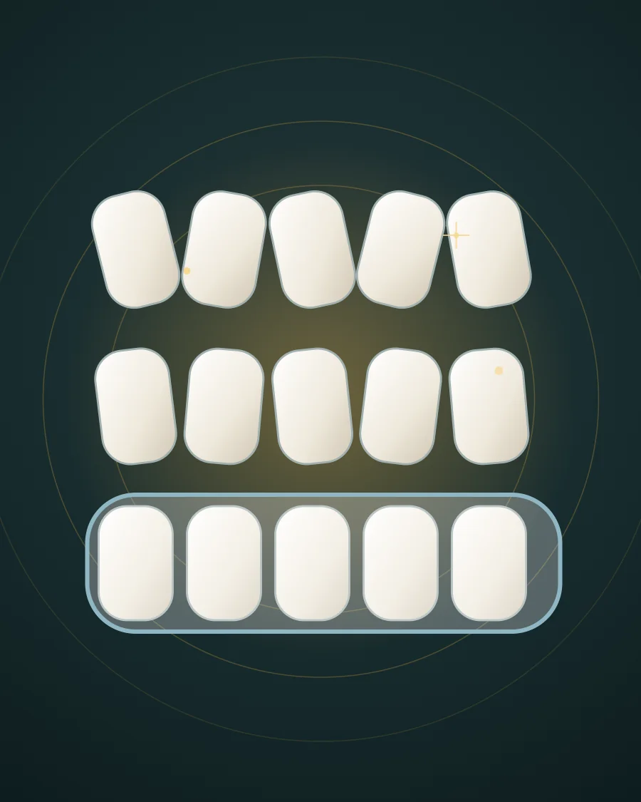 Illustration of three rows of teeth, crooked at the start, straighter in the middle and aligned at the end under a clear tray, drawn in Elite Dental gold and charcoal