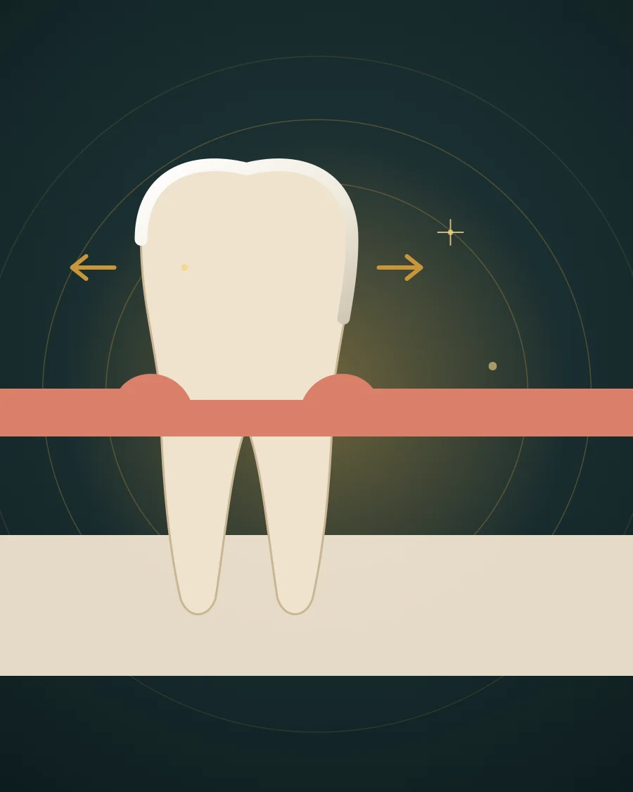 Illustration of a tooth with the gum and bone level lowered around its root and arrows showing the tooth moving from side to side, drawn in Elite Dental gold and charcoal