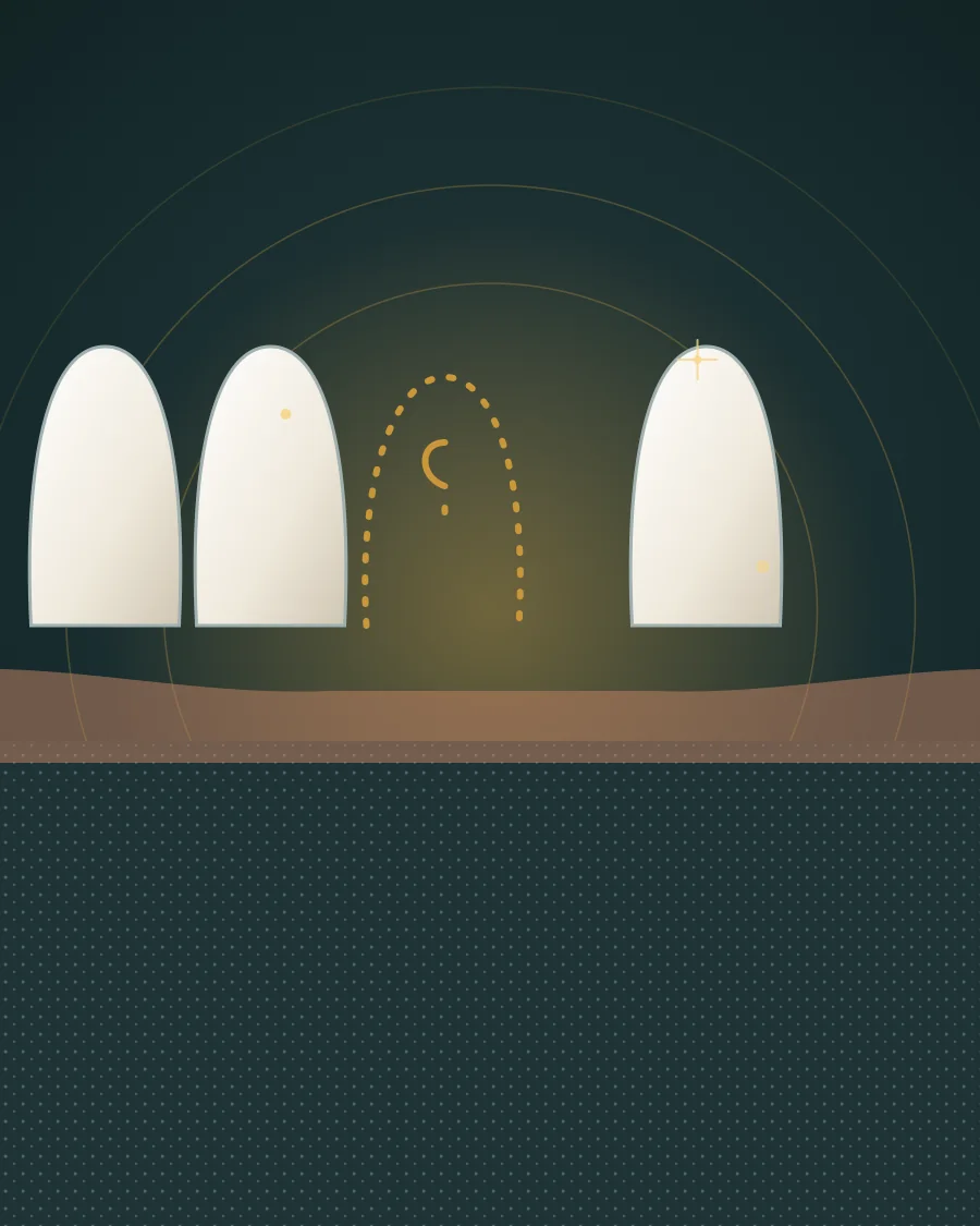 Illustration of a row of teeth with a gap where one tooth is missing, shown by a dotted outline, drawn in Elite Dental gold and charcoal