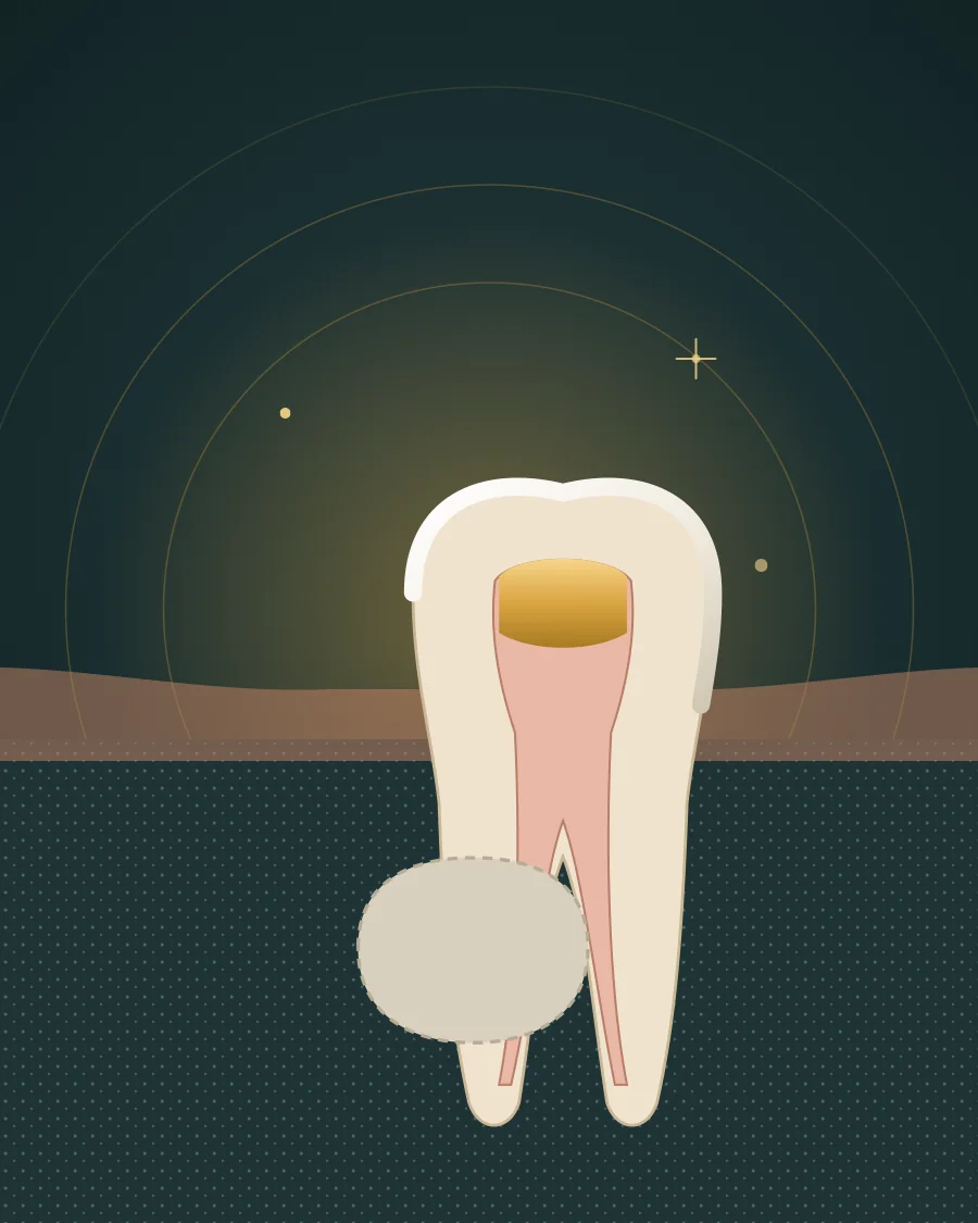 Illustration of a baby molar with its pulp chamber and roots, and the adult tooth waiting beneath it, drawn in Elite Dental gold and charcoal