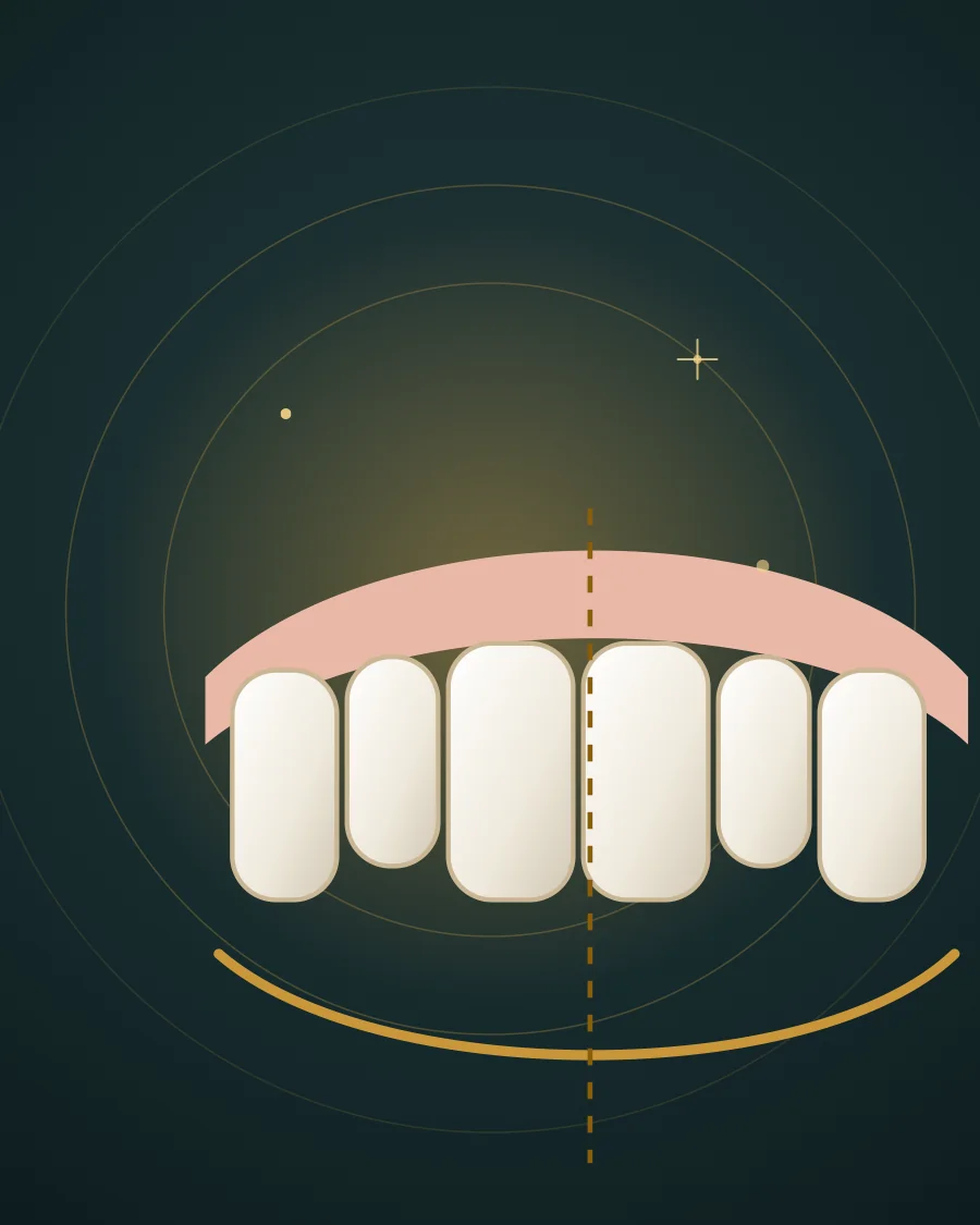 Illustration of six upper front teeth with the midline, gum line and smile curve marked, drawn in Elite Dental gold and charcoal