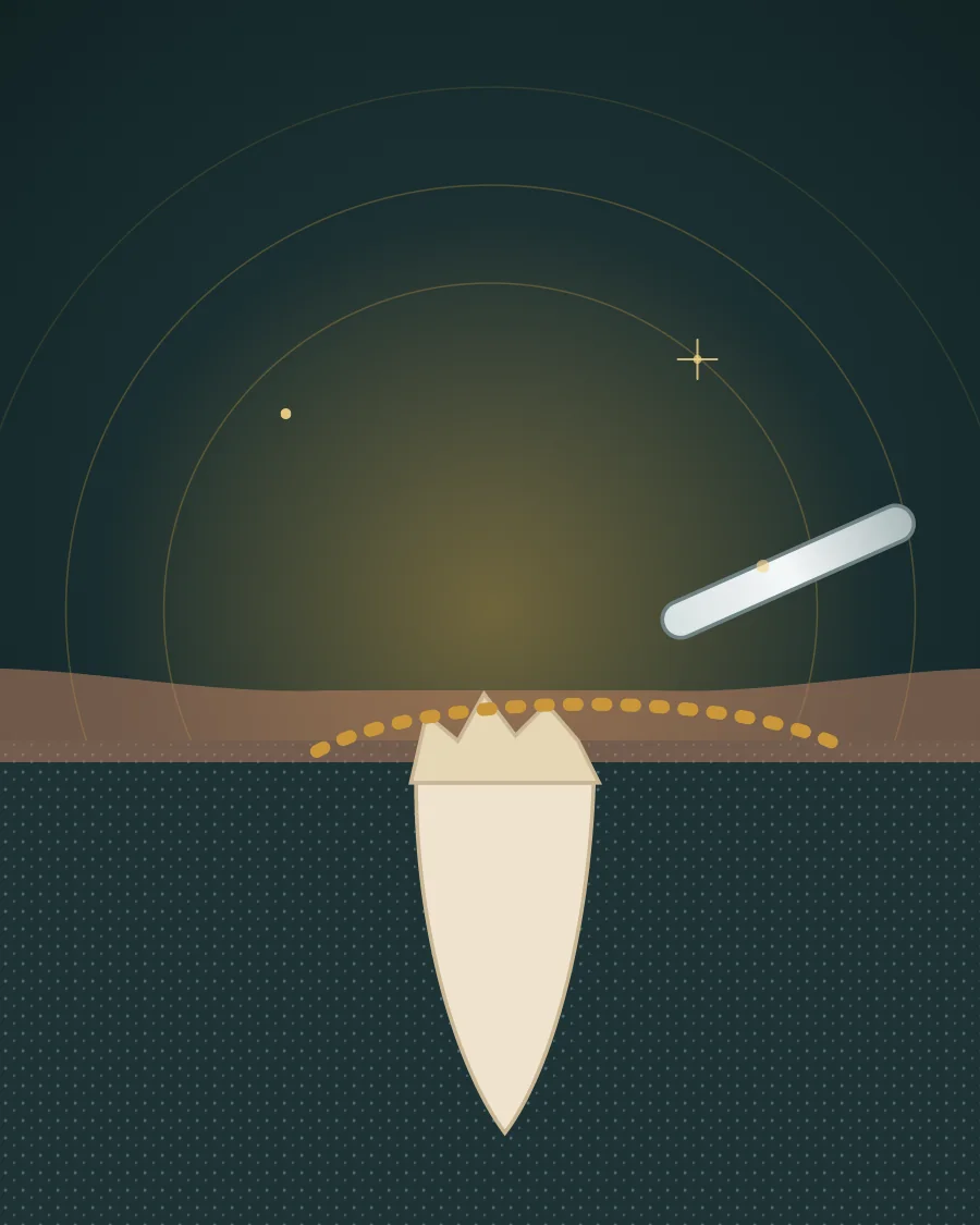 Illustration of a broken tooth with only its root left in the jaw, a dotted incision line in the gum and a small instrument, drawn in Elite Dental gold and charcoal
