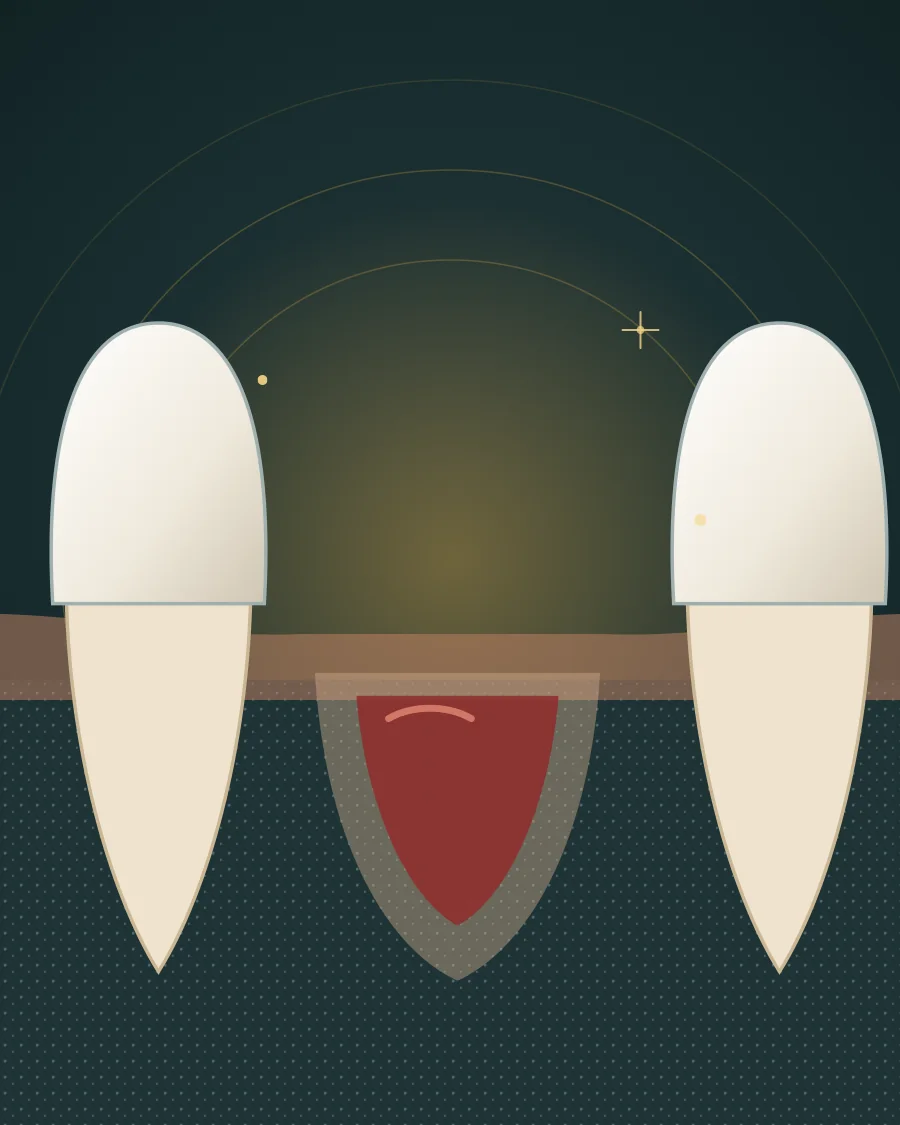 Illustration of the jaw after a tooth is removed, with a blood clot in the socket between two neighbouring teeth, drawn in Elite Dental gold and charcoal